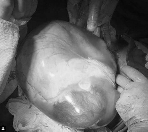 Ảnh hiếm 80 nghìn ca mới có một về bé chào đời trong bọc ối - 13