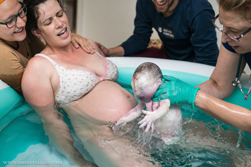 Ảnh hiếm 80 nghìn ca mới có một về bé chào đời trong bọc ối - 3