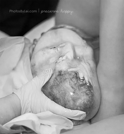 Ảnh hiếm 80 nghìn ca mới có một về bé chào đời trong bọc ối - 4