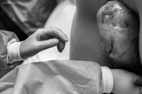 Ảnh hiếm 80 nghìn ca mới có một về bé chào đời trong bọc ối - 5