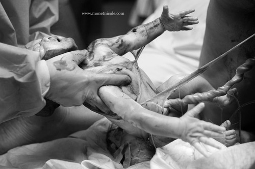 Ảnh hiếm 80 nghìn ca mới có một về bé chào đời trong bọc ối - 7