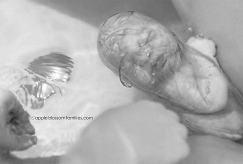 Ảnh hiếm 80 nghìn ca mới có một về bé chào đời trong bọc ối - 8