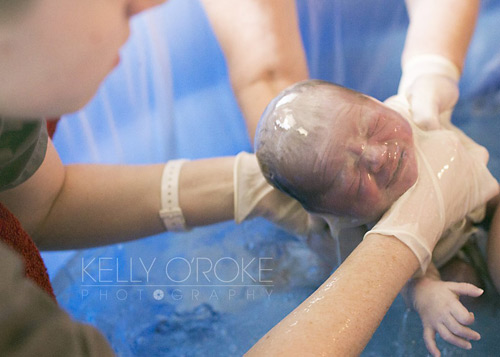 Ảnh hiếm 80 nghìn ca mới có một về bé chào đời trong bọc ối - 9