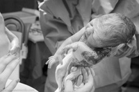 Xót lòng những em bé sơ sinh có nội tạng nằm ngoài cơ thể - 2