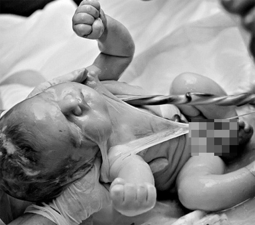 Ảnh hiếm 80 nghìn ca mới có một về bé chào đời trong bọc ối - 10