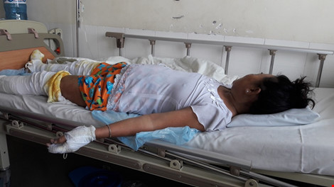 Tưới xăng đốt người tình, một người chết, 2 bị thương - 3