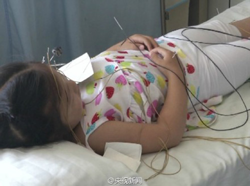 Bé gái 5 tuổi liệt mặt vì mẹ bật điều hoà suốt đêm - 1