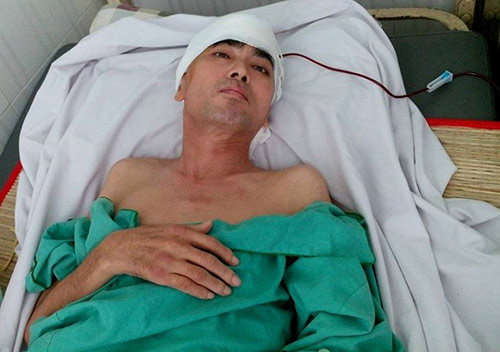 Diễn viên Nguyễn Hoàng dần hồi phục sau ca ghép hộp sọ - 1