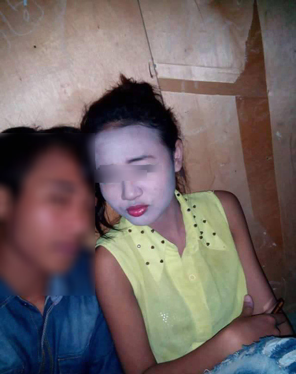 NGUYÊN NHÂN KHIẾN DA MẶT TRẮNG SÁNG HƠN CÁC VÙNG DA KHÁC TRÊN CƠ THỂ