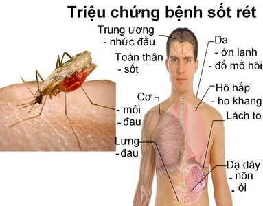 Một người sốt rét ác tính tử vong do nhầm sốt xuất huyết - 1