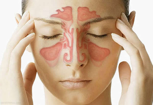 Phân biệt viêm mũi dị ứng và viêm mũi không do dị ứng - 1