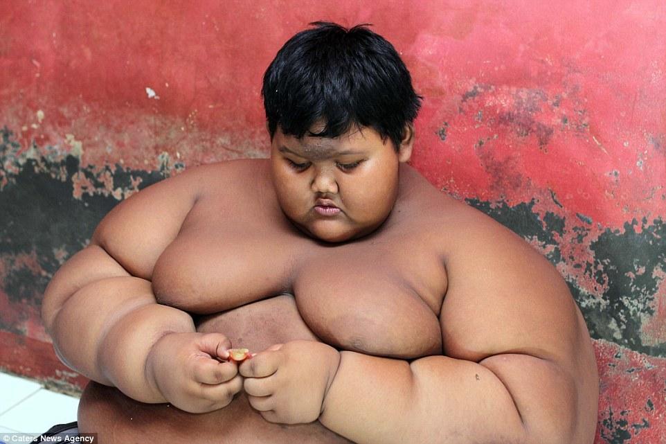 Hình ảnh khó tin trước và sau 8 năm của cậu bé béo nhất thế giới - 4