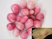 Đẹp - Là phẳng sẹo thâm, sẹo lồi lâu năm với công thức từ hành tím