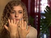 Sức khỏe - Hôn mê sau cơn đau họng, cô gái trẻ tỉnh dậy sợ hãi phát hiện mất 6 ngón tay, 2 ngón chân