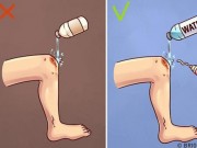 Sức khỏe - Tự sơ cứu vết thương tại nhà đơn giản nhưng nhiều người sai lầm, rước họa vào thân