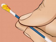 Sức khỏe - Màu sắc ráy tai 'tố cáo' gì về sức khỏe của bạn?