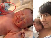 Bà bầu - Sự thật về em bé chào đời vẫn nắm chặt chiếc vòng tránh thai của mẹ trên tay