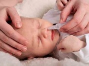 Làm mẹ - Cách trị sổ mũi cho trẻ sơ sinh đơn giản nhất mà nhiều mẹ hay quên dùng