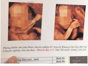 Vợ cay đắng nhường chồng, nhường bố của con cho những người bạn thích "đốt nhà"