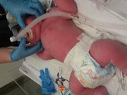 Bà bầu - Sau 3 giờ nỗ lực đẻ thường thất bại, bố mẹ ‘sốc nặng’ khi mổ đẻ ra con thế này