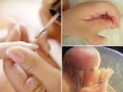 Mẹ bầu làm đẹp phải tránh 8 điều này để không sinh con dị tật