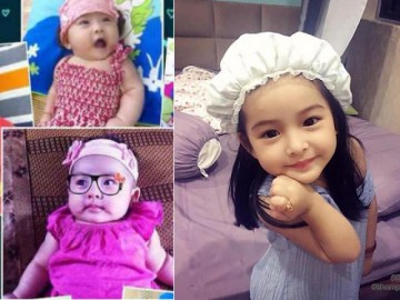 Bé gái thoát khỏi lưỡi hái tử thần giữa tâm sởi cách đây 3 năm giờ ra sao?