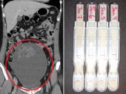 Bà bầu - Sau 7 lần thử thai, cô gái chết lặng khi bác sĩ tiết lộ sự thật khủng khiếp