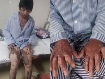 Ký ức đau thương của người vợ sống sót sau khi bị chồng nhốt rồi tưới xăng đốt cả hai