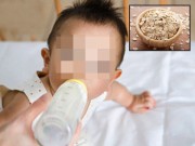 Làm mẹ - Bé 7 tháng tuổi tử vong vì được bố mẹ cho ăn sữa thực vật liên tục