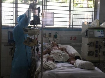 Bị chó con cào nhẹ, dính luôn bệnh dại nguy kịch