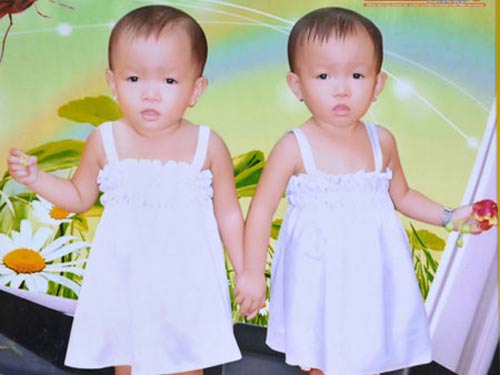 Lạ lùng với ấp sinh đôi - 3