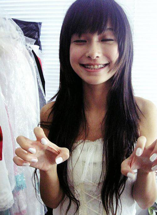 Angelababy lộ vết #039;cuồng#039; dao kéo - 9