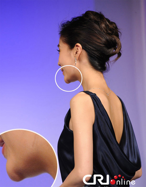 Angelababy lộ vết #039;cuồng#039; dao kéo - 2