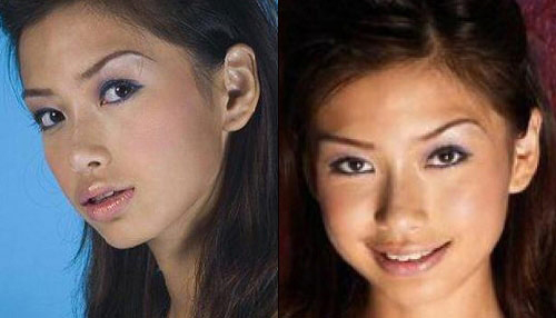 Angelababy lộ vết #039;cuồng#039; dao kéo - 12