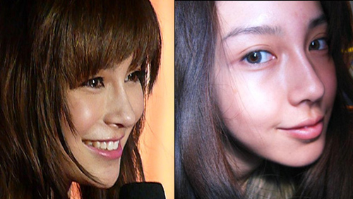 Angelababy lộ vết #039;cuồng#039; dao kéo - 14