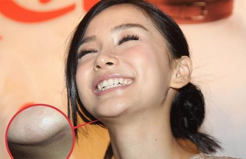 Angelababy lộ vết #039;cuồng#039; dao kéo - 5