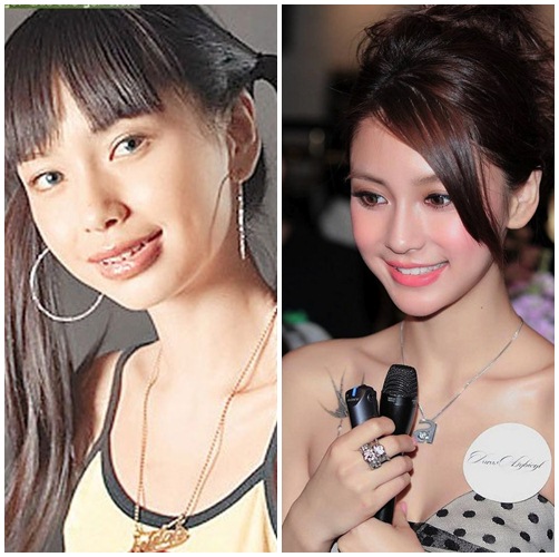 Angelababy lộ vết #039;cuồng#039; dao kéo - 6