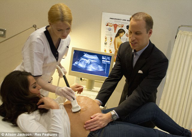 Cho tới thời điểm này, giới tính của em bé vẫn chưa được các bác sĩ tiết lộ, ngay cả hoàng tử William và Công nương Kate cũng chưa biết đứa bé trong bụng Kate là trai hay gái.
