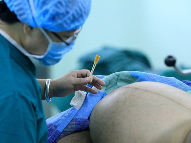 Ca sinh nở diễn ra tại bệnh viện thành phố Tam Hiệp Môn, tỉnh Hồ Nam, Trung Quốc.
