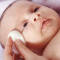 Làm mẹ - Không chảy nước mắt là tắc tuyến lệ?
