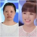 Làm đẹp - PTTM lung linh cho cô gái hỏng hàm răng