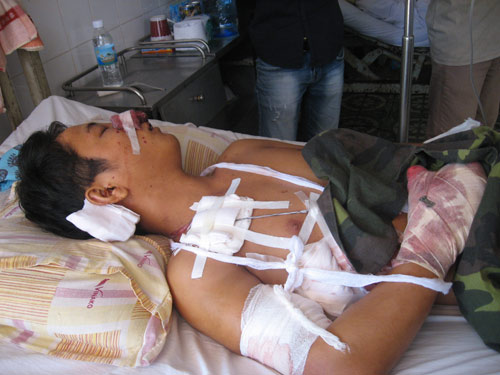 Nổ bình gas mini, nam thanh niên nguy kịch - 1