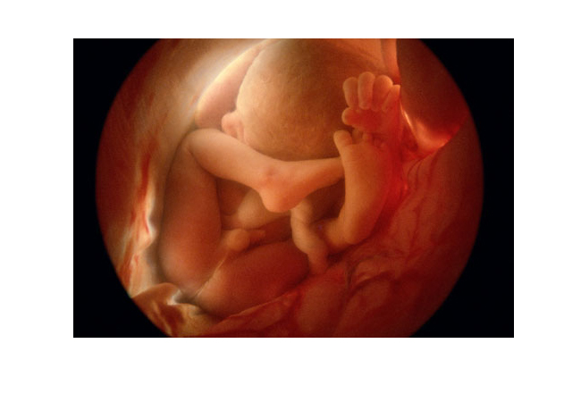 Thai nhi 36 tuần

Các bé giai đoạn này khác nhau về cân nặng, kích thước, phụ thuộc vào nhiều yếu tố như giới tính, số bé đang ở trong bụng mẹ và phụ thuộc vào cả cơ thể của người mẹ nữa. Do đó, tỷ lệ tăng trưởng tổng thể của bé cũng quan trọng không kém gì kích thước thực tế bé phát triển. Trung bình, bé sẽ nặng khoảng 2,4kg và cao 38cm. Bộ não phát triển rất nhanh chóng, gần như là phát triển hoàn thiện.
