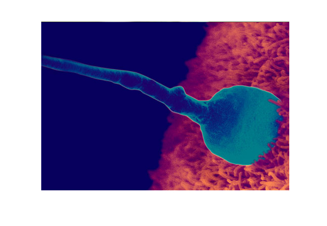 Thụ thai

Nếu một tinh trùng gặp và thâm nhập vào trứng thì quá trình thụ tinh sẽ diễn ra. Đây cũng chính là quá trình thụ thai. Tại thời điểm này, gen di truyền trong đó có cả giới tính được hình thành. Trong khoảng 3 ngày kể từ ngày thụ thai, trứng đã thụ tinh được phân chia nhanh chóng vào rất nhiều tế bào, đi qua các ống dẫn trứng vào trong tử cung, tại đây, chúng sẽ bám chặt vào thành từ cung. Nhau thai, bộ phận nuôi dưỡng em bé cũng sẽ được hình thành ngay từ lúc này.
