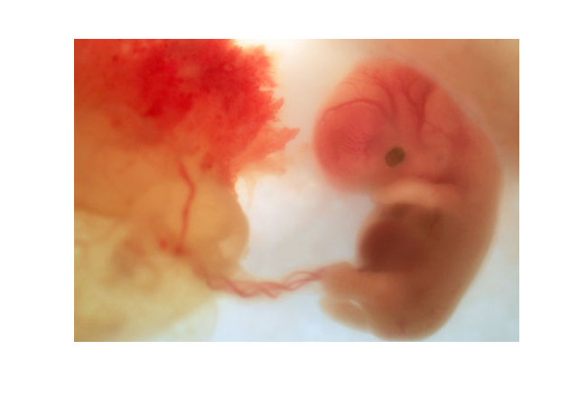Thai nhi 8 tuần

Kích cỡ của em bé lúc này chỉ bằng một quả nho – chỉ khoảng gần 3cm. Mí mắt và đôi tai đang được hình thành và thậm chí đầu mũi đã có thể nhìn thấy được. Cánh tay và chân cũng được hình thành. Các ngón tay và ngón chân mọc dài hơn và rõ rệt hơn.
