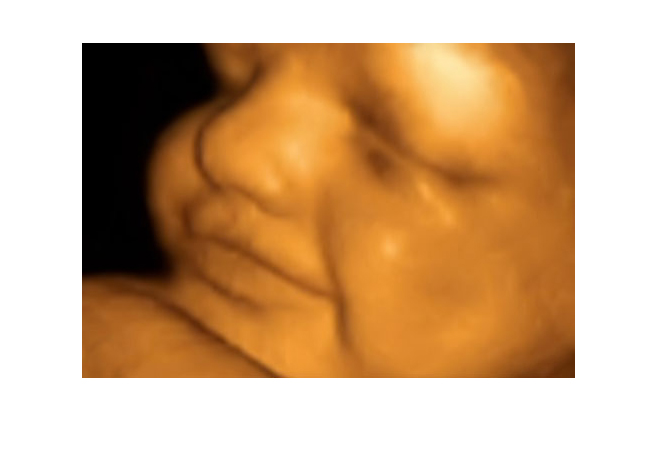 Thai nhi 24 tuần

Thai nhi lúc này nặng khoảng 0,6kg. Bé phản ứng với âm thanh bằng cách di chuyển hoặc nhịp tim đập nhanh hơn. Bạn có thể cảm nhận được các cú đạp mạnh của bé. Tai của bé được phát triển đầy đủ trong giai đoạn này, bé có thể cảm nhận được và phản ứng bằng cách lộn ngược trong bụng mẹ.
