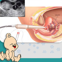 Tận mắt xem thụ tinh trong ống nghiệm