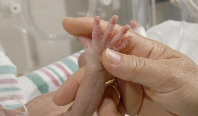 Hàng năm, theo thống kê của WHO, trên thế giới có khoảng 15 triệu ca sinh non. Trẻ sinh dưới 37 tuần được cho là sinh non. Tuy nhiên, có một số trường hợp kỷ lục sinh non từ trong khoảng 19-23 tuần. Lúc đấy, cơ thể trẻ mới chỉ hình thành những đường nét cơ bản đầu tiên. Cùng ngắm những em bé sinh non nhỏ nhất thế giới.
