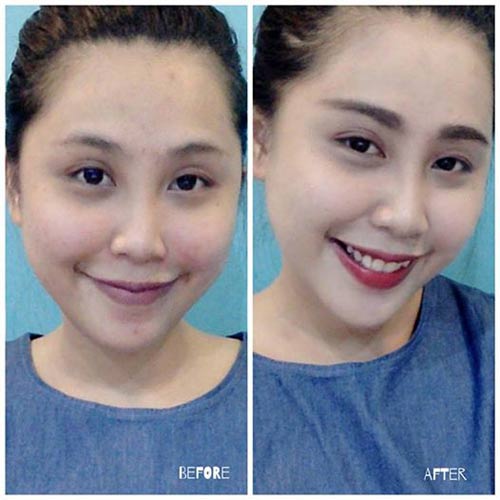 Hot girl Gào tự tin để mặt mộc nhiều mụn - 3