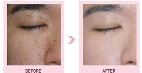 Hot girl Gào tự tin để mặt mộc nhiều mụn - 6